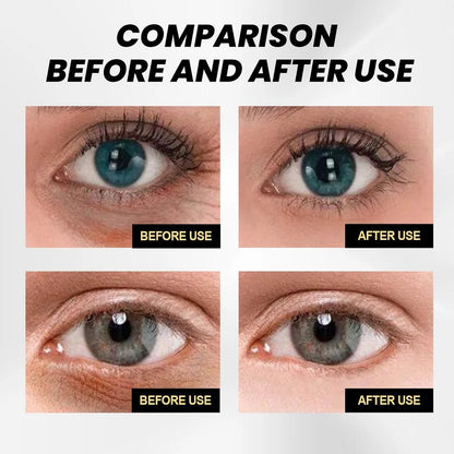 🎉Buy One Get One Free🎁 -  Instant Firming Eye Cream