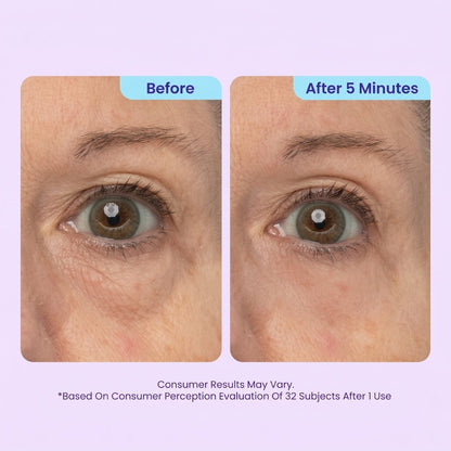 🎉Buy One Get One Free🎁 - Instant Lift Eye Gel